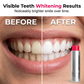🔥LAST DAY SALE £10.99!!⚡50K+ SOLD!🦷 Stain‑Removing Whitening Mouthwash – Deep Clean Stains, Brighten Teeth & Freshen Breath Instantly ✨